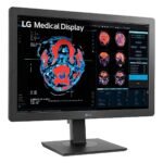 MONITOR LGX 24INCH 2MP IPS DIAGNOSTIC